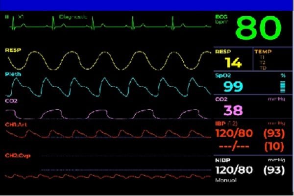 monitor best-icu-cardiac-monitor-rent-nearby-your-loaction